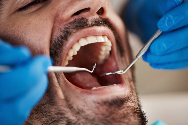 Emergency Dentist Open Today in IL